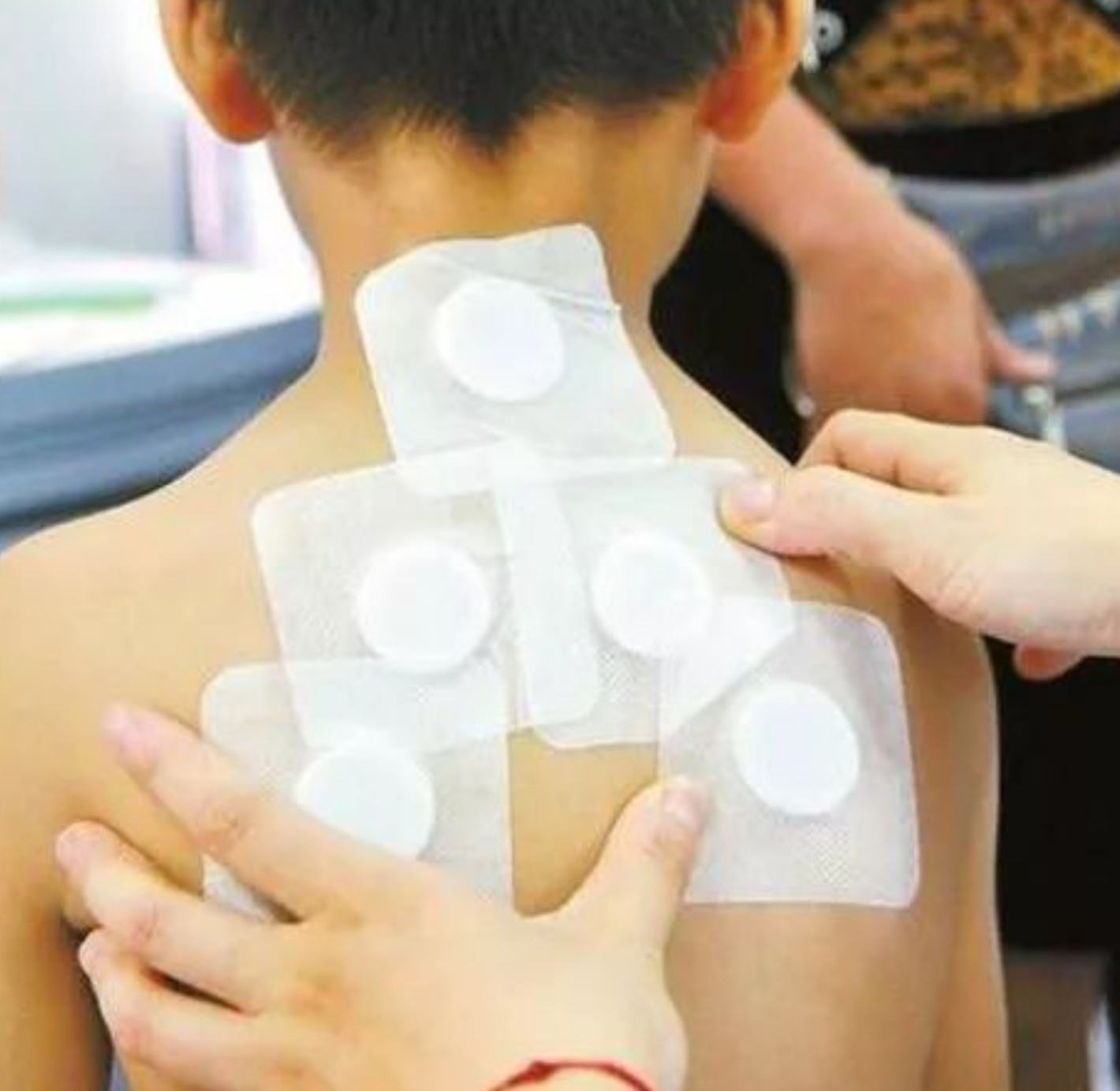 2、三伏貼在脖子上，有一根針，看起來(lái)很疼。怎么了